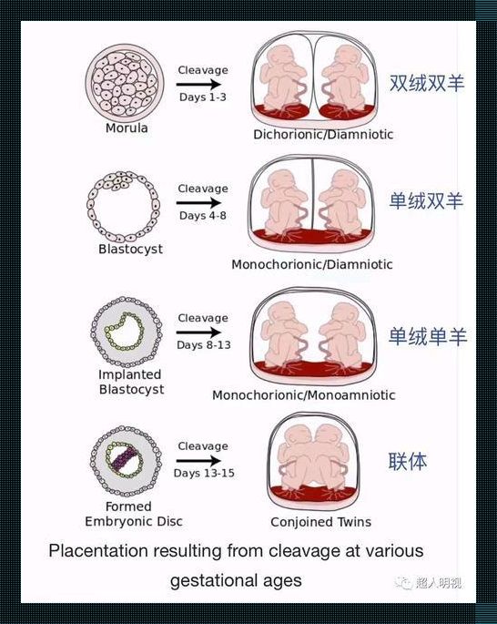 “单绒单羊双胞胎，天下无双的‘奇’遇！”