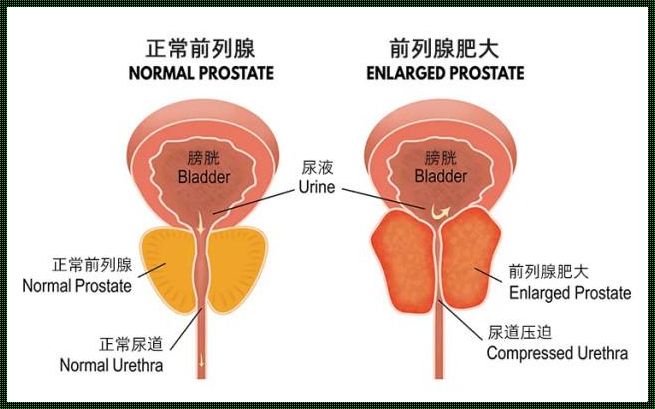 前列腺大如斗，幽默评审谁最溜