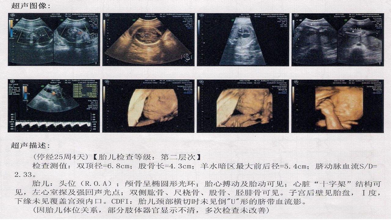 系统B超和大排畸，这差距不是一星半点！