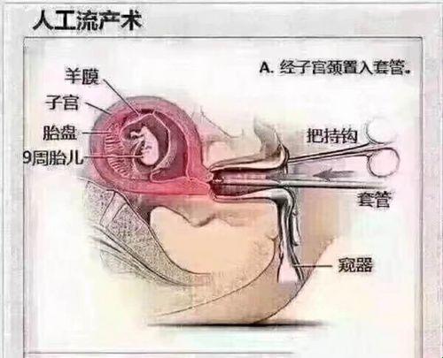 如何优雅地自我淘汰：一种 黑粉视角下的生活艺术