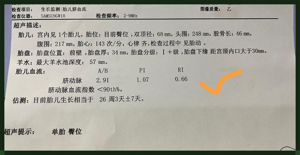 “Sd值偏高”，自个儿会“跳水”吗？