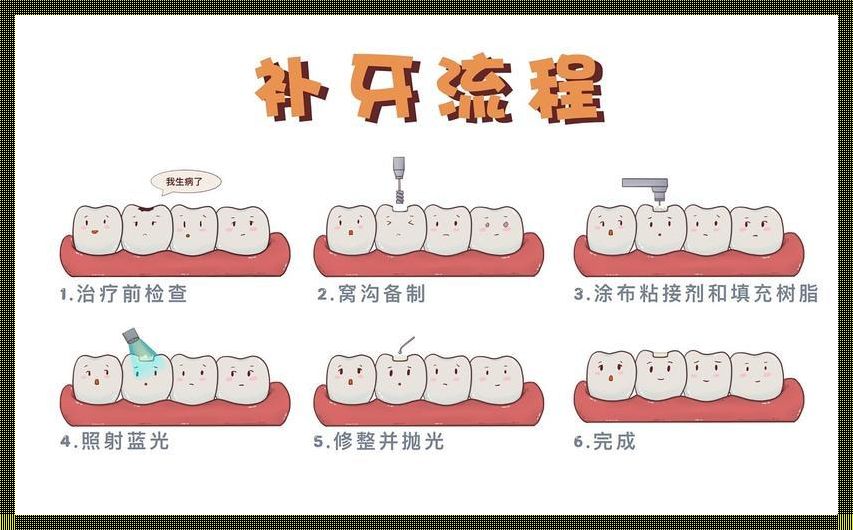 补牙三部曲：笑问牙医知多少