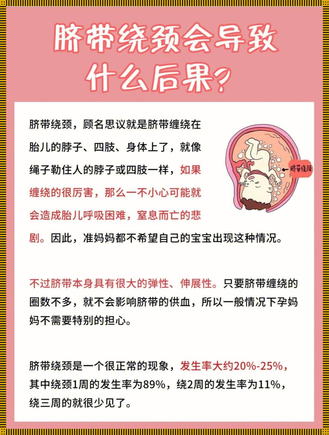 脐带绕颈，财运亨通的神秘传说