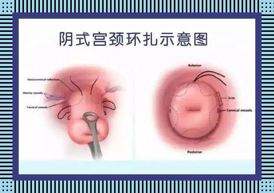 孕程三分，打胎可否？笑谈间，解构生死