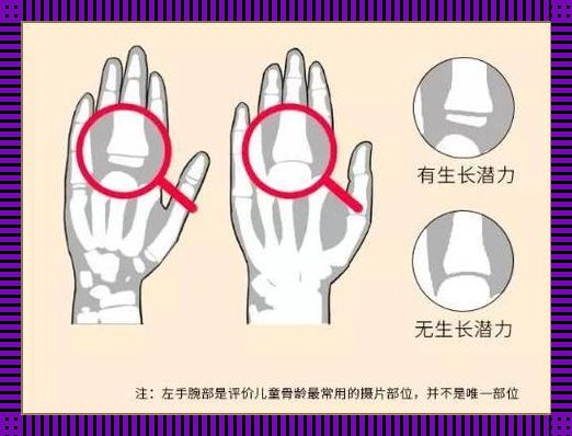 母婴店测骨龄，精准度靠谱吗？搞笑揭秘！