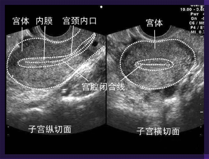 《阴超和彩超，揭秘“孕”味十足的神秘面纱》