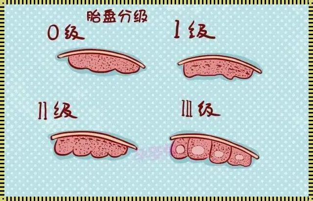 “胎盘成熟度2+，孕妈们的‘火箭发射’倒计时多久开始？”