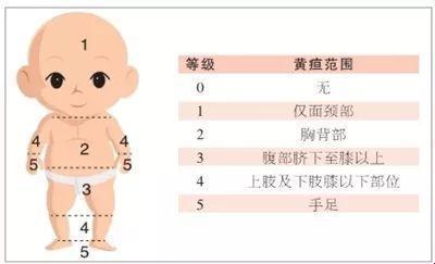 “母乳性黄疸”大揭秘：宝宝的小脸儿为何黄澄澄？