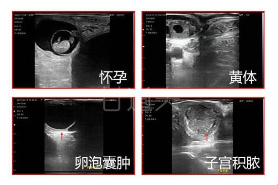 B超神探！妇科疾病一照现形，女同胞们的秘密武器！